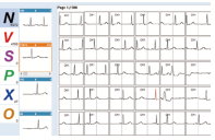 Holter