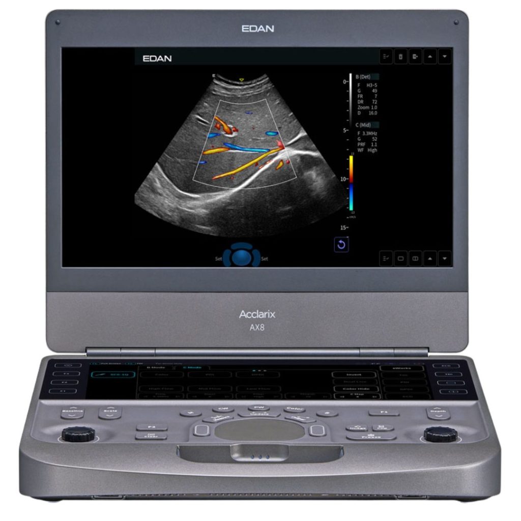 Ecógrafo doppler color